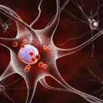 Effect of nutrition on neurodegenerative diseases